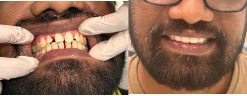 Clinical Precision